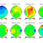 نقشه برداری مغزی یا QEEG و کاربرد آن در شناسایی عملکرد رفتاری و شناختی مغز
