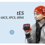 خرید دستگاه tDCS در کرج